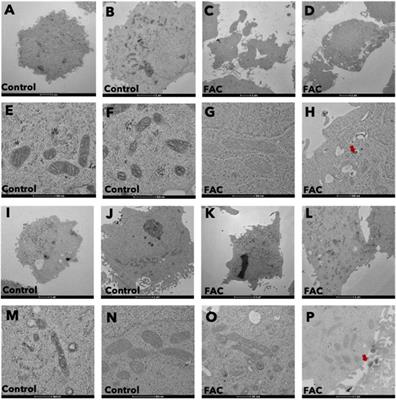 Iron-induced kidney cell damage: insights into molecular mechanisms and potential diagnostic significance of urinary FTL